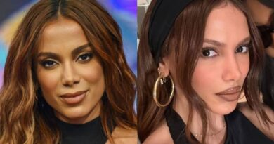 Anitta exibe ‘novo rosto’ após afastamento das redes sociais por infecção bacteriana