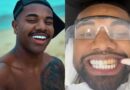 Ex-BBB Davi Brito se arrepende e troca de lentes de contato dos dentes após virar piada na web: “Estava muito grande”