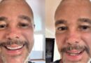 Netinho surge de novo visual após tratamento contra câncer e celebra: “Olha como Deus é bom”