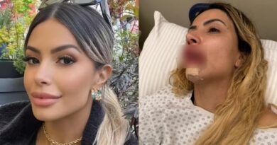 Modelo brasileira eleita como “mulher perfeita” é agredida por namorado em São Paulo