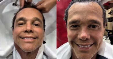 Netinho celebra retorno de crescimento capilar após tratamento contra câncer: “Deus é muito bom”