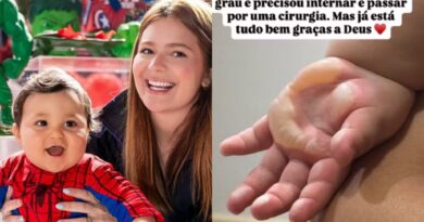 Filho de Viih Tube sofre queimadura de 2º grau e passa por cirurgia