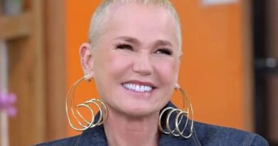 Xuxa passa por pequena cirurgia em São Paulo