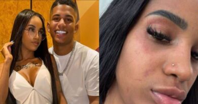 Influenciadora baiana acusa marido de agressão, expõe ferimentos no rosto e alega influência da religião