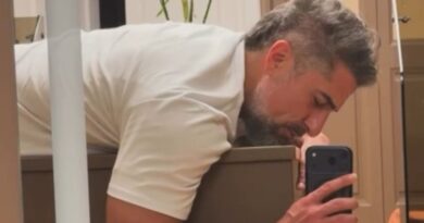 Marcos Mion sofre com crise de hérnia