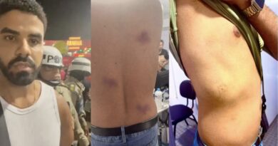 Justiça afasta quatro PMs envolvidos em confusão com agressão e homofobia no Carnaval de Salvador