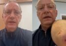 VÍDEO: Apresentador José Roberto Burnier leva quatro pontos após ataque de pitbull em São Paulo