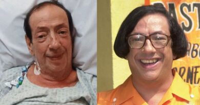 Marcos Oliveira, O Beiçola de “A Grande Família” apresenta melhora após cirurgia