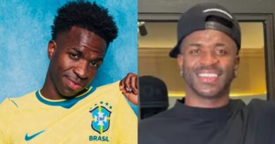 Vini Jr. é submetido a harmonização facial e chama atenção nas redes sociais; confira antes e depois